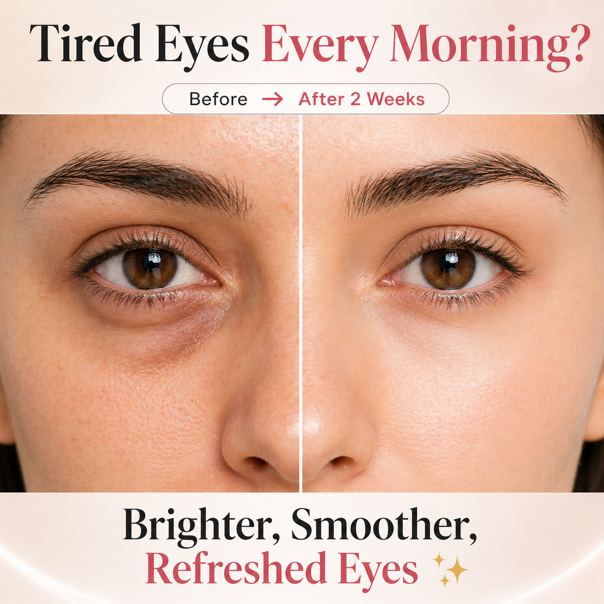 EyeLume™ Pro – 2-in-1 Eye Renewal Device