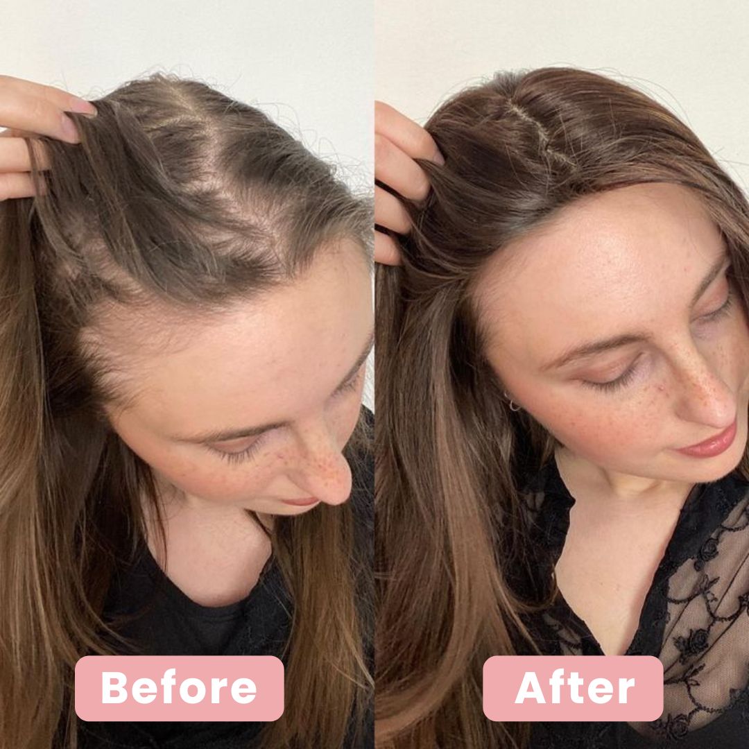 Thinning Hair Starts at the Scalp — Fix It at the Root
