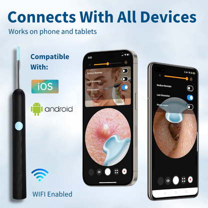 SafeEar™ Wax Removal Cam-Kit