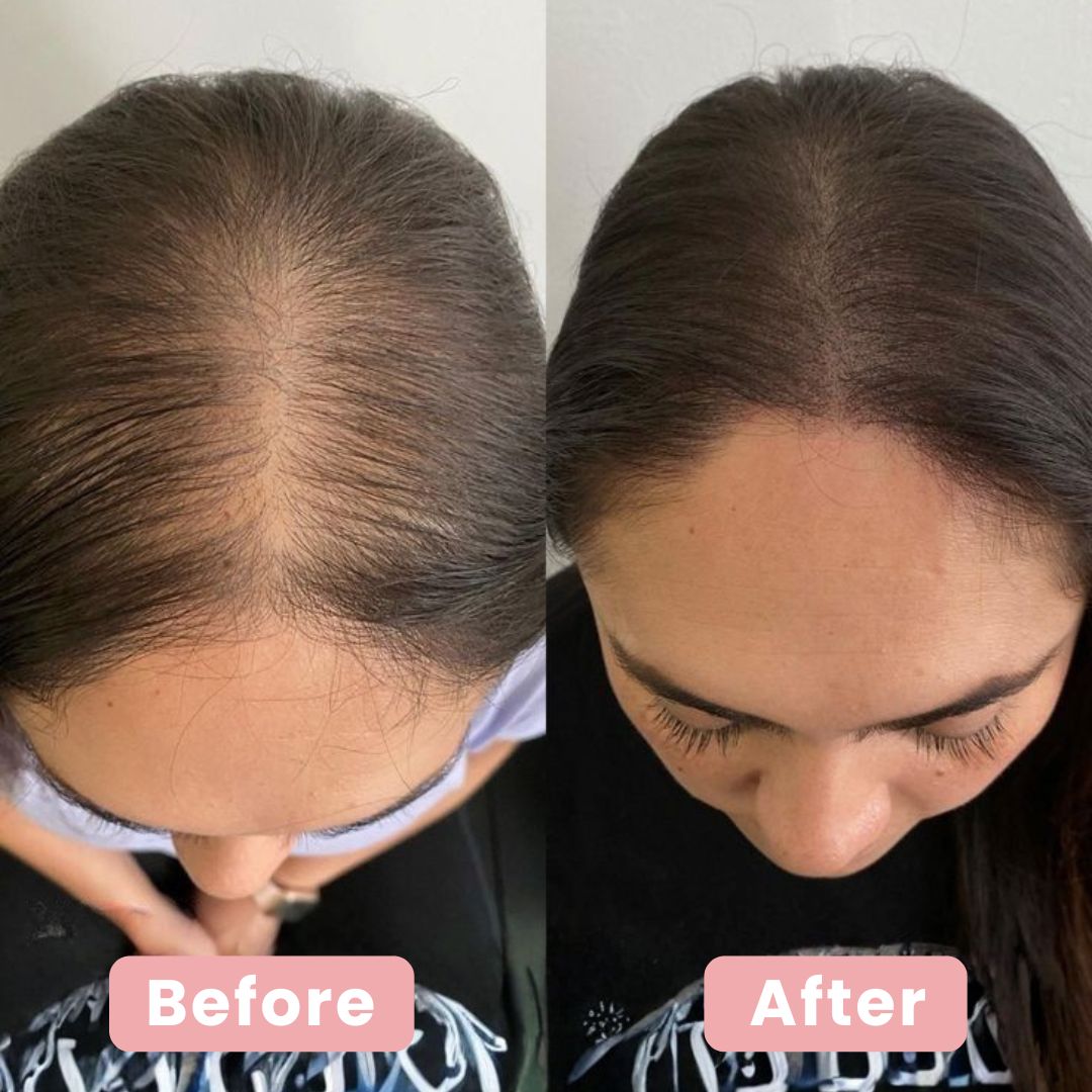 Thinning Hair Starts at the Scalp — Fix It at the Root