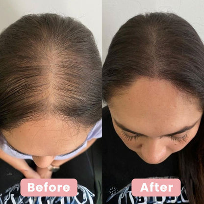 Thinning Hair Starts at the Scalp — Fix It at the Root